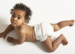 natural diaper rash treatment